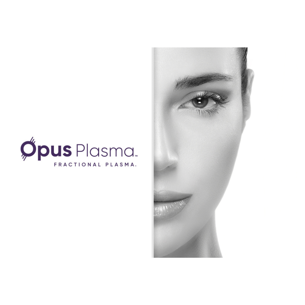 Opus Plasma Featured Image